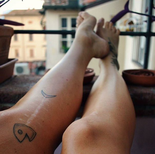 14 vet seo bien hoa thanh hinh xam cuc chat