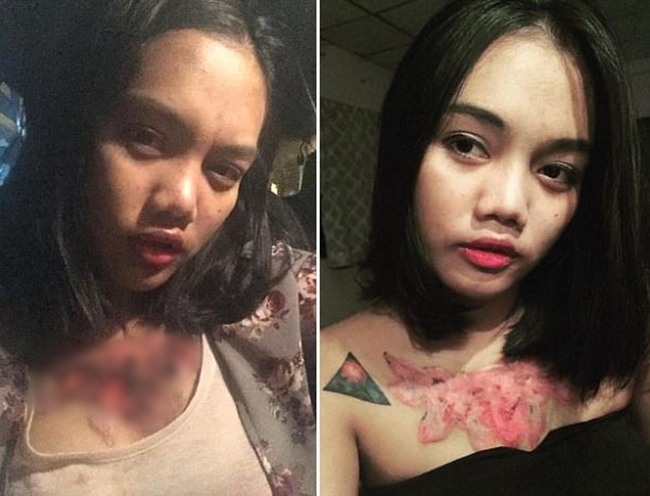 xoa hinh xam hoa hong khung tren nguc nu sinh vien thai lan phai nhan cai ket dau don