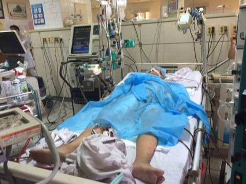 benh nhan thu 8 trong vu tai bien chay than nhan tao o bvdk hoa binh da tu vong