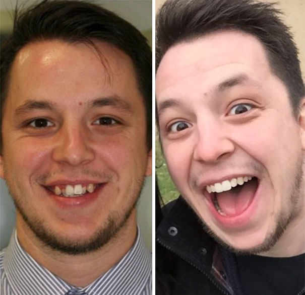 19 khuon mat thay doi ngoan muc chung to suc manh cua nieng rang that la vi dieu