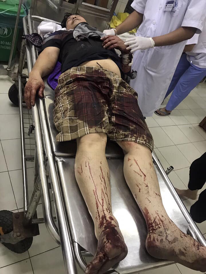 hai duong can som lam ro vu viec mot gia dinh bi nhom con do vao tan nha truy sat