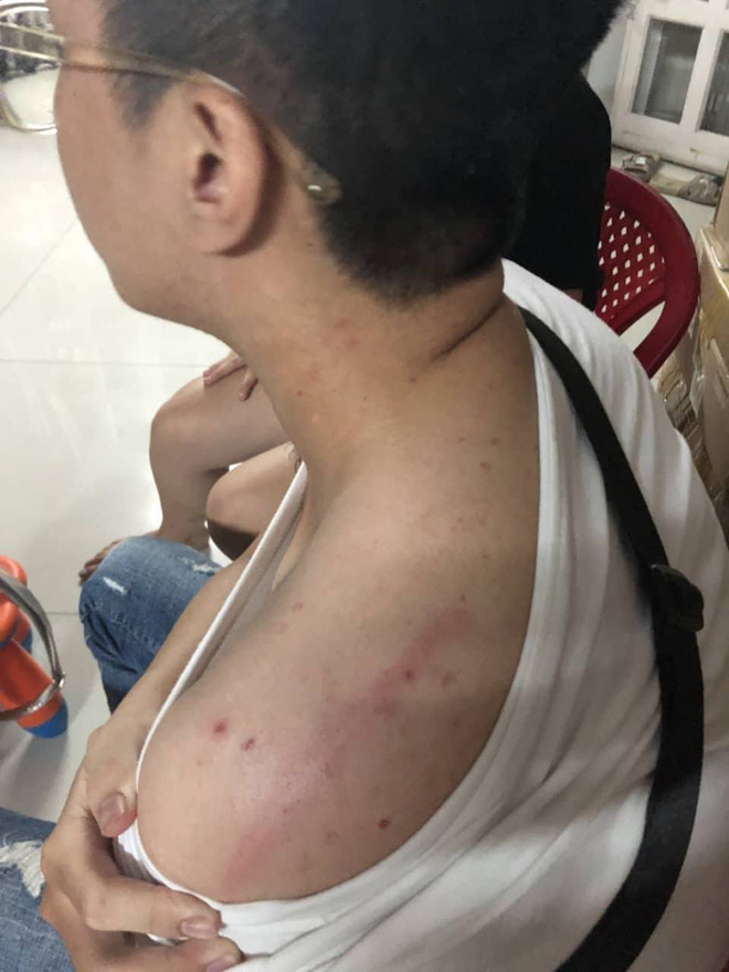 thanh nien 19 tuoi cung ban gai bi nhom nguoi hanh hung cuong doat tai san roi bat ky giay no 400 trieu dong