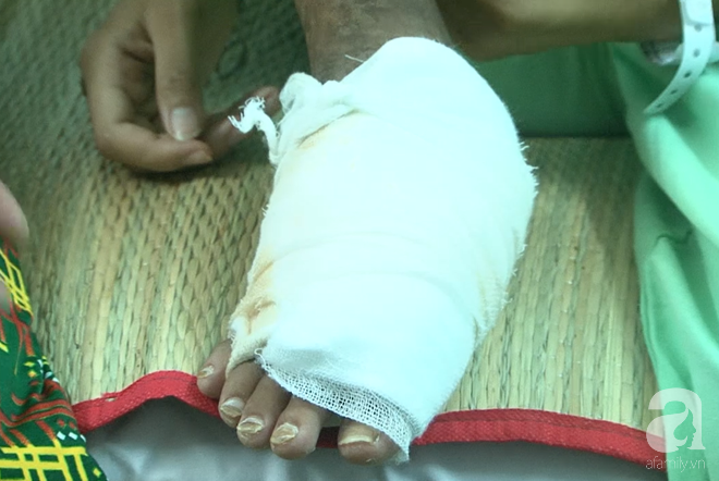 bi ran can khong di vien ma qua 3 thay lang chua chan be gai 13 tuoi bi hoai tu den loi xuong