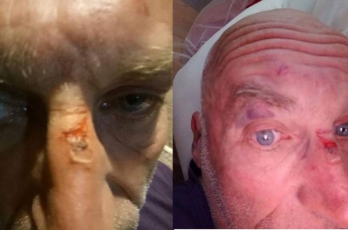 vu xo xat sau va cham giao thong o sa pa nguoi dan ong ha lan bi o to chen ep nen chui nhom thanh nien truoc khi au da