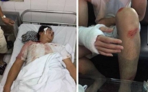 con do hanh hung da man luc nua dem 4 nguoi o ha noi nhap vien