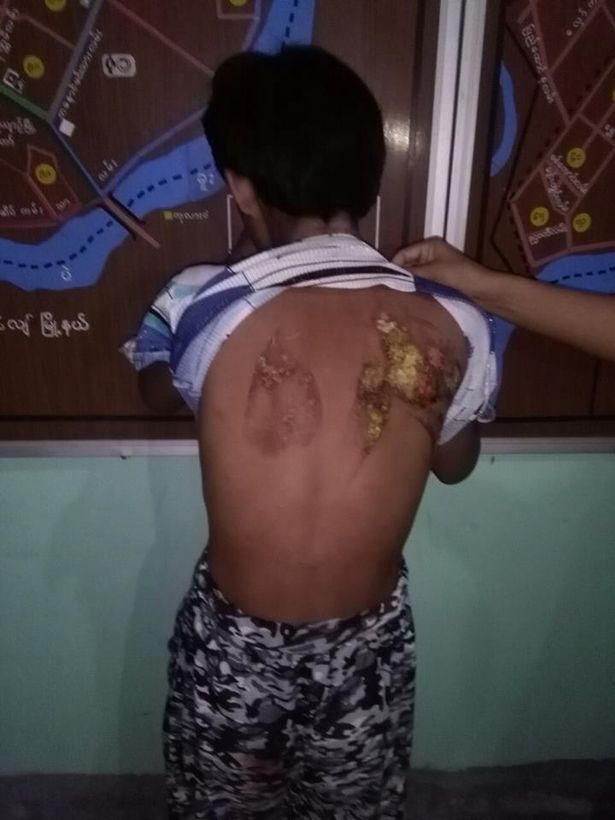 co be 13 tuoi di lam giup viec bi chu nha dung ban la nong bao hanh roi do nuoc soi len nguoi