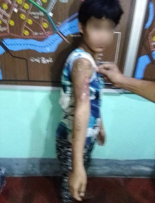 co be 13 tuoi di lam giup viec bi chu nha dung ban la nong bao hanh roi do nuoc soi len nguoi