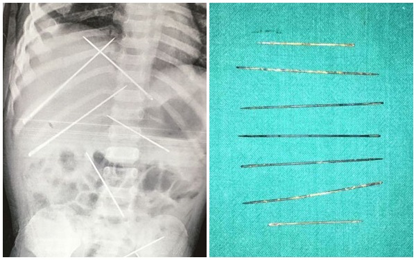 me mu quang tin thay lang con gai 3 tuoi tu vong vi bi xam hai co the chua day kim gam