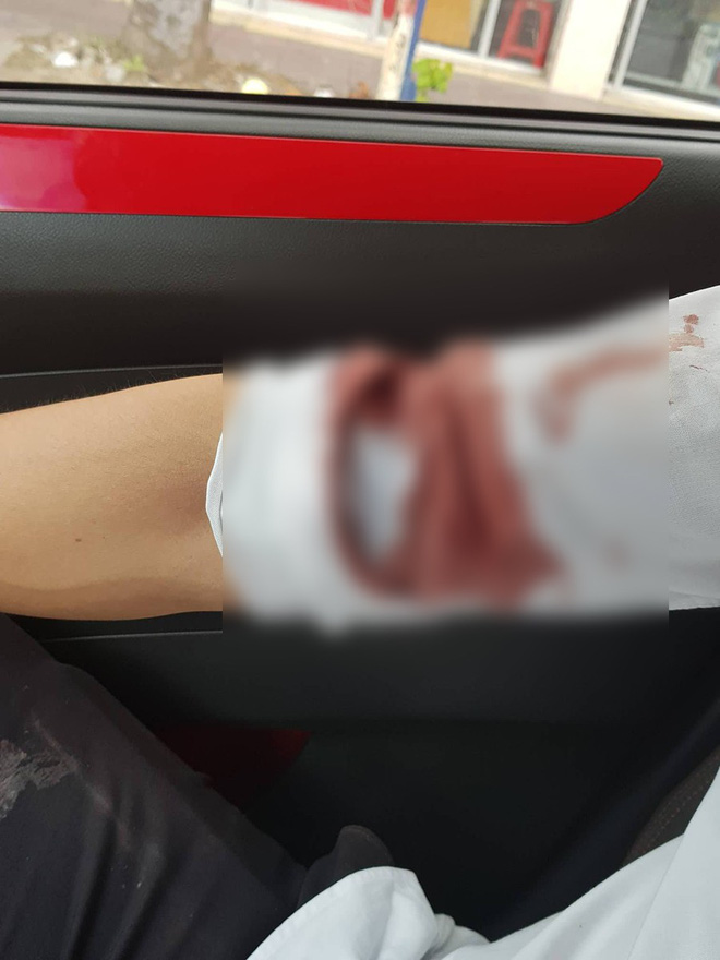 nghi an phong vien dang tac nghiep thi bi tai xe lai to o dam va hanh hung trong thuong o sai gon