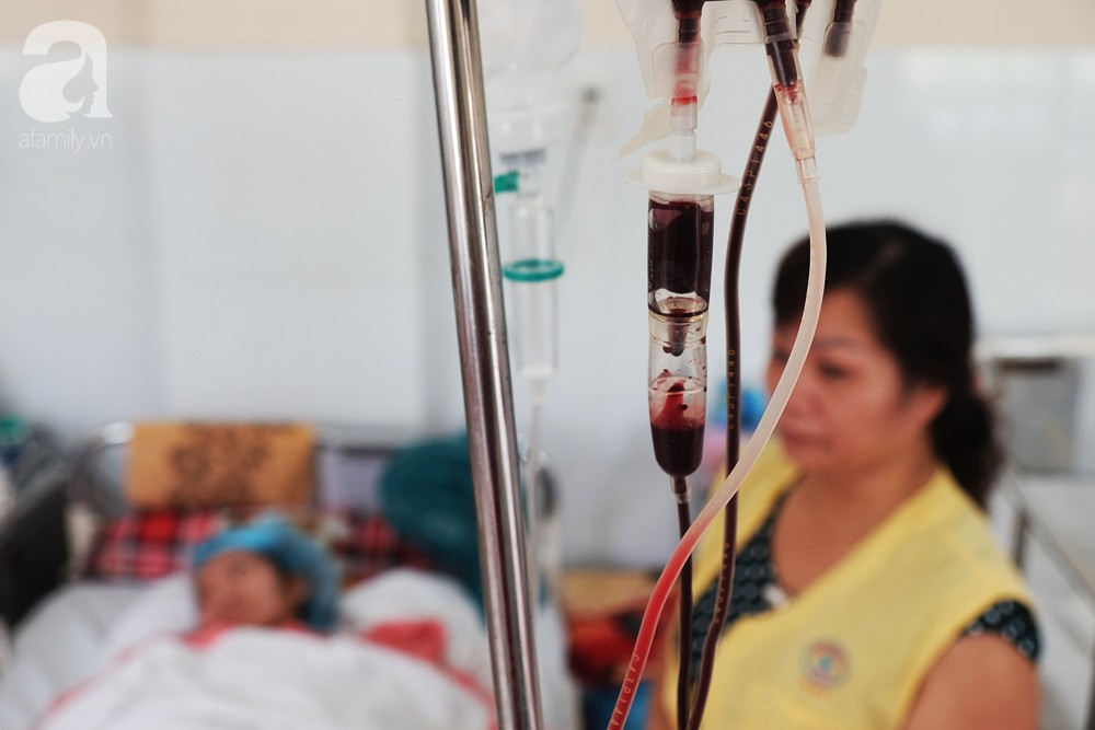 tphcm thuong tam canh thai phu tre va nguoi yeu bong nang vi chay nha truoc ngay cuoi
