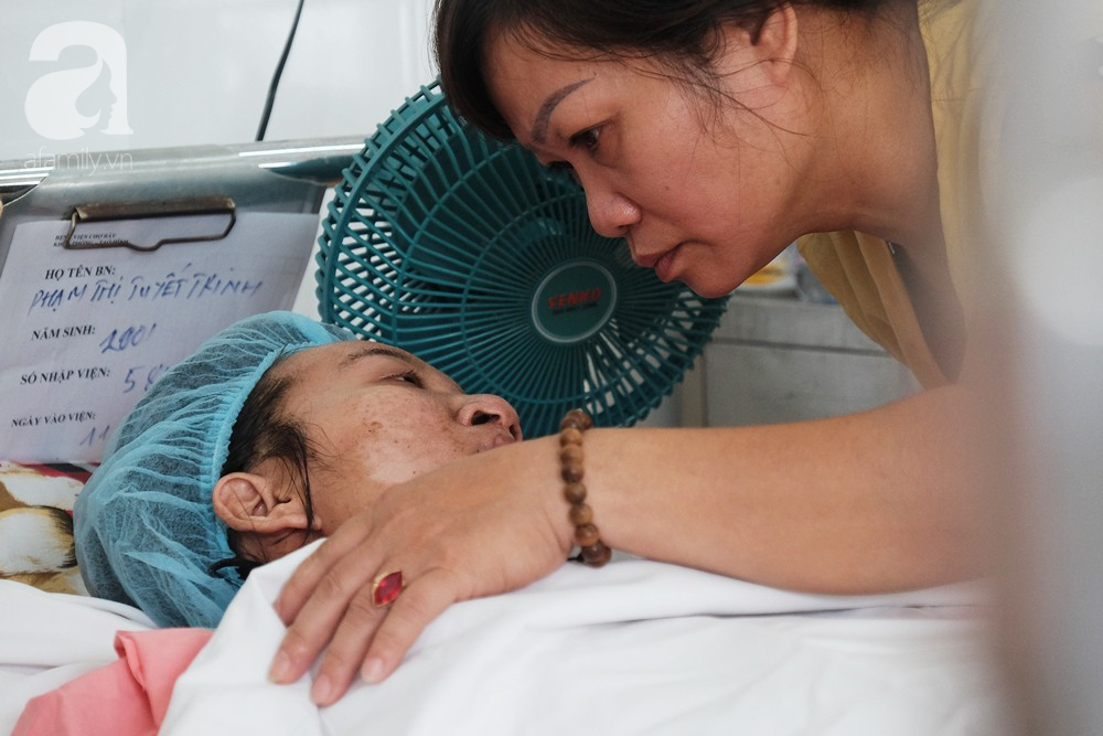 tphcm thuong tam canh thai phu tre va nguoi yeu bong nang vi chay nha truoc ngay cuoi