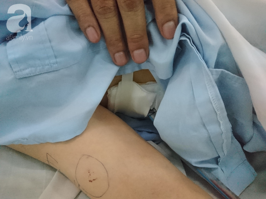 tphcm bi cat dut tinh cam nam thanh nien dung sung va dao tan cong hai nguoi phu nu da man roi tu tu