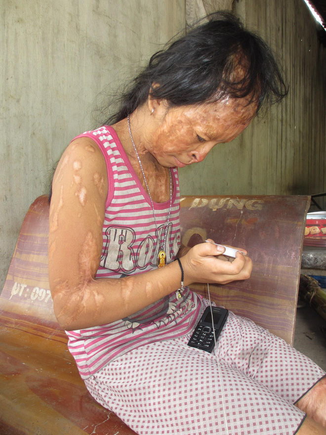 vu danh ghen tat axit kinh hoang va nguyen vong xin doi mat cua tu tu nguyen huu tinh