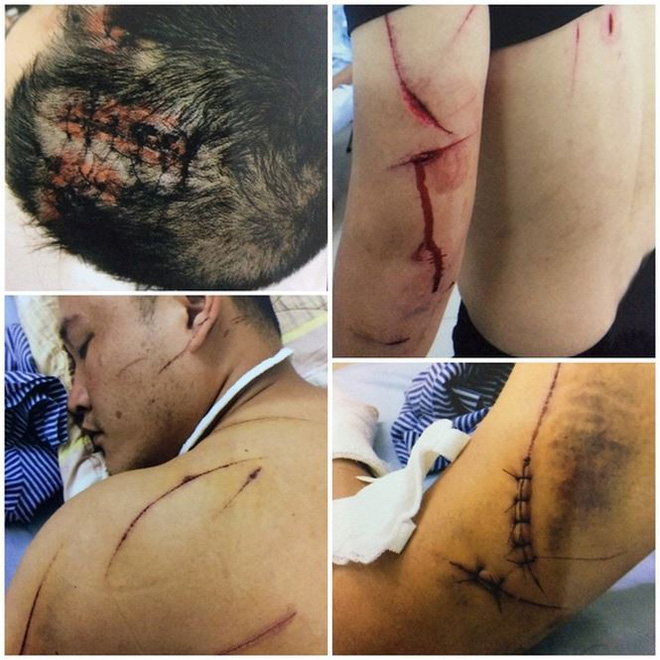 hai phong nguoi dan ong to bi nhom con do dung dao kiem chem guc tai quan ca phe