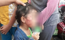 phan no bao mau danh lien tiep vao dau tre de chong oi