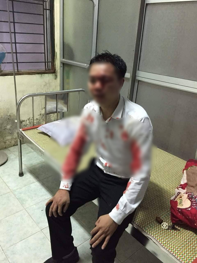 nhan vien hang xe mazda bi nhom doi tuong trum ao mua hanh hung da man giua duong