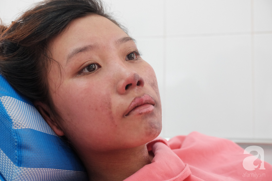 len sai gon lam viec phu me nuoi em thieu nu 18 tuoi bi binh gas mini lam bong nang