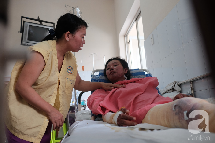 len sai gon lam viec phu me nuoi em thieu nu 18 tuoi bi binh gas mini lam bong nang