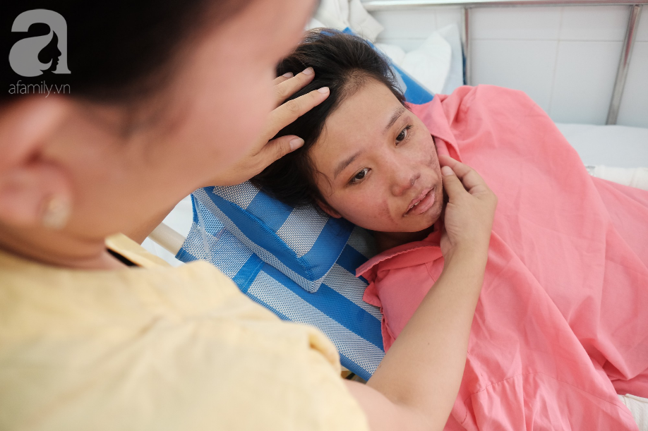 len sai gon lam viec phu me nuoi em thieu nu 18 tuoi bi binh gas mini lam bong nang