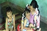 xot thuong so phan dua be bi bong nang tai tinh quang nam