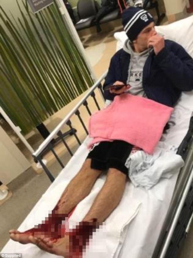 khong phai ca piranha sinh vat bien bi an an thit nguoi dang khien nhieu nguoi so hai