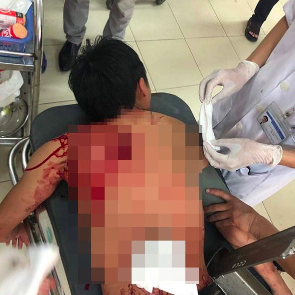 danh nhau tai dam cuoi nam thanh nien bi chem guc tai cho