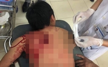 danh nhau tai dam cuoi nam thanh nien bi chem guc tai cho