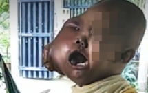 buc tam thu dam nuoc mat cua nguoi me co con gai bi ung thu mau