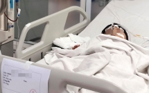 Cả gia đình bị đàn ong vò vẽ đốt khi dọn nhà, bà và cháu chết thảm, 3 người còn lại nguy kịch