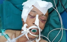 tphcm nguoi dan ong chan thuong so nao vi tai nan van chua co nguoi than vao nhan sau 2 ngay nam vien