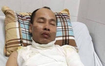 bat giu ke chu muu vu tat axit nu phu bep o hoa binh