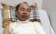 cuoc song cua co gai bi tat axit trung 1 ty trong ai la trieu phu 8 nam truoc