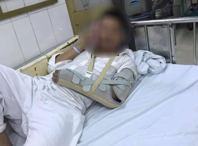 ha noi gio the do thach thuc sau va cham giao thong tai xe o to bi thanh nien di xe may danh nhap vien