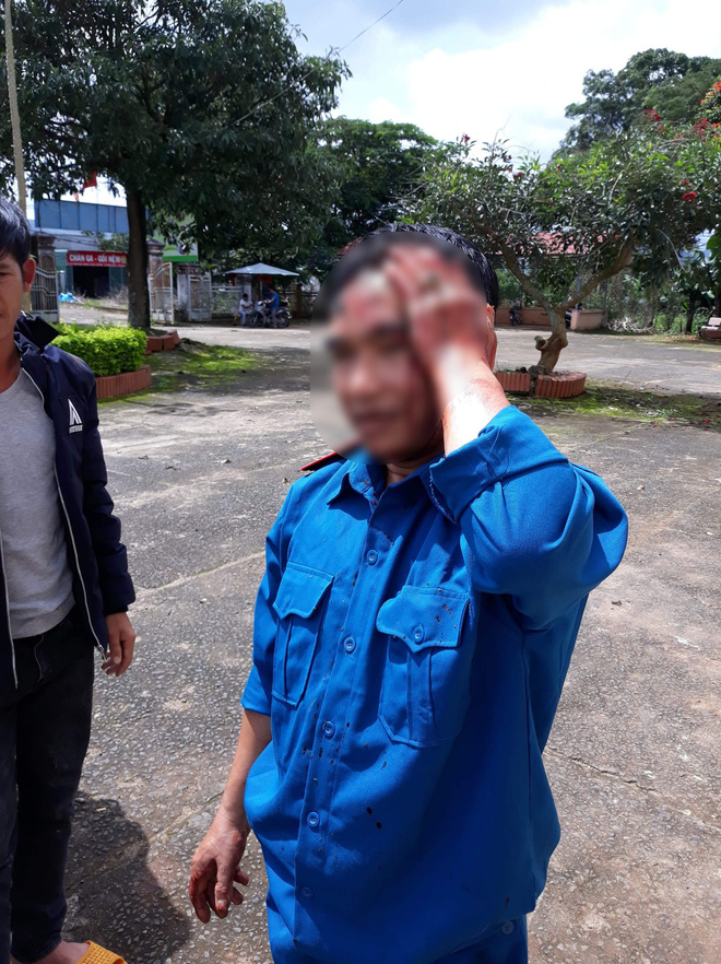 lam dong tien hanh giai toa 1400m2 dat lan chiem 2 can bo bao ve rung bi chem trong thuong