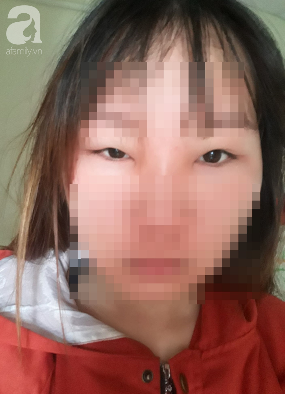 dung my pham dan toc mong da dep lot xac co gai 19 tuoi bi bien dang ca mat mat hip lai va sung vu kinh di