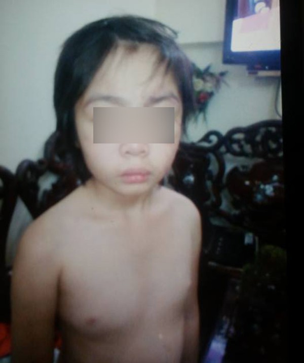 loi cuoi tai toa cua bo va me ke bao hanh con trai ran so nao hay cham soc con nhieu hon dung vap phai toi loi nhu bi cao