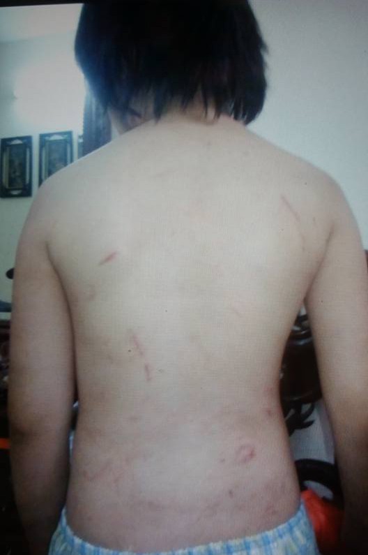 loi cuoi tai toa cua bo va me ke bao hanh con trai ran so nao hay cham soc con nhieu hon dung vap phai toi loi nhu bi cao