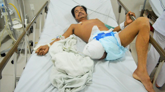 benh nhan o quang binh song sot ky dieu sau 6 ngay bi ran doc can