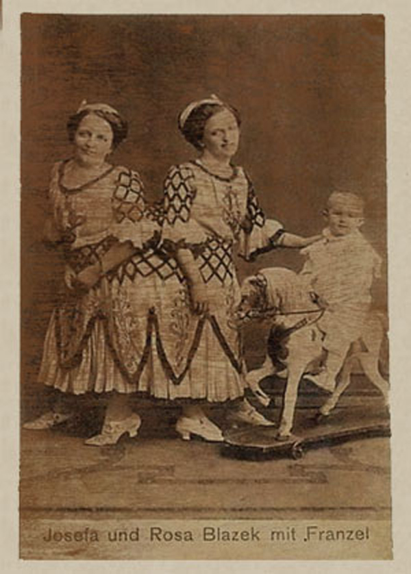 doi song tinh duc bi an va thi phi cua cap nu song sinh lien than noi tieng lich su