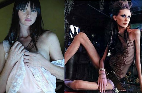 su that tran trui phia sau than hinh manh mai cua nguoi mau nhin an tiem thuoc rua ruot hang ngay