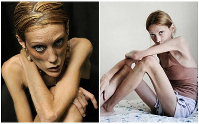 su that tran trui phia sau than hinh manh mai cua nguoi mau nhin an tiem thuoc rua ruot hang ngay