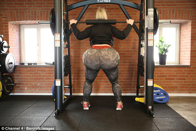 co gai tre lieu linh hut mo de don mong 4 lan gio vong 3 da dat ky luc 177cm