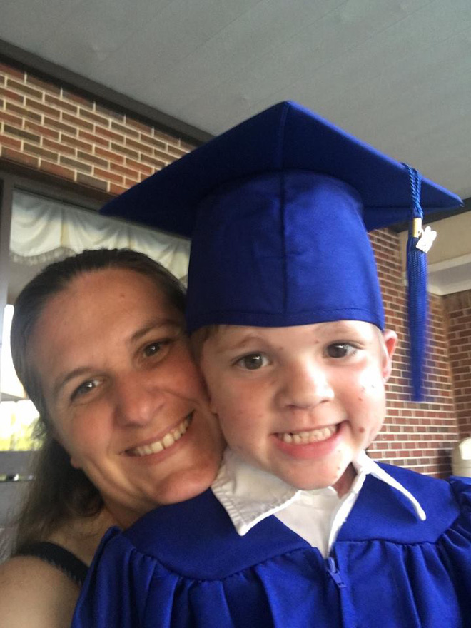 me dau don khi nhin thay 80 co the cua con so sinh phu day vet bot vay nhung do van chua phai la dieu toi te nhat