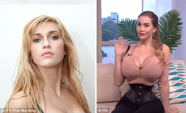 thanh phau thuat tham my len thot 200 lan roi ma van chua cai duoc con nghien lam dep