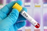 virus zika la gi trieu chung cua nguoi nhiem virus zika