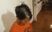 tphcm thieu nu 14 tuoi bi nhom thanh nien la mat chem len dau khong ro ly do phai khau gan 30 mui