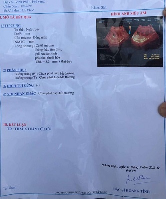 vu chan doan sai suyt bo thai nhi o hue bo y te yeu cau kiem tra lam ro bao chi phan anh