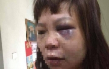 khoi to bat tam giam ke danh dap da man co gai 18 tuoi say thai