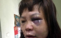 khoi to bat tam giam ke danh dap da man co gai 18 tuoi say thai