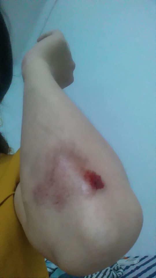 vu thanh nien di sh hanh hung ba bau 8 thang cong an vao cuoc dieu tra